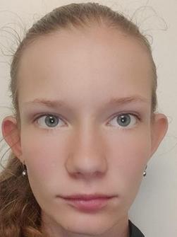 STENING Rut
